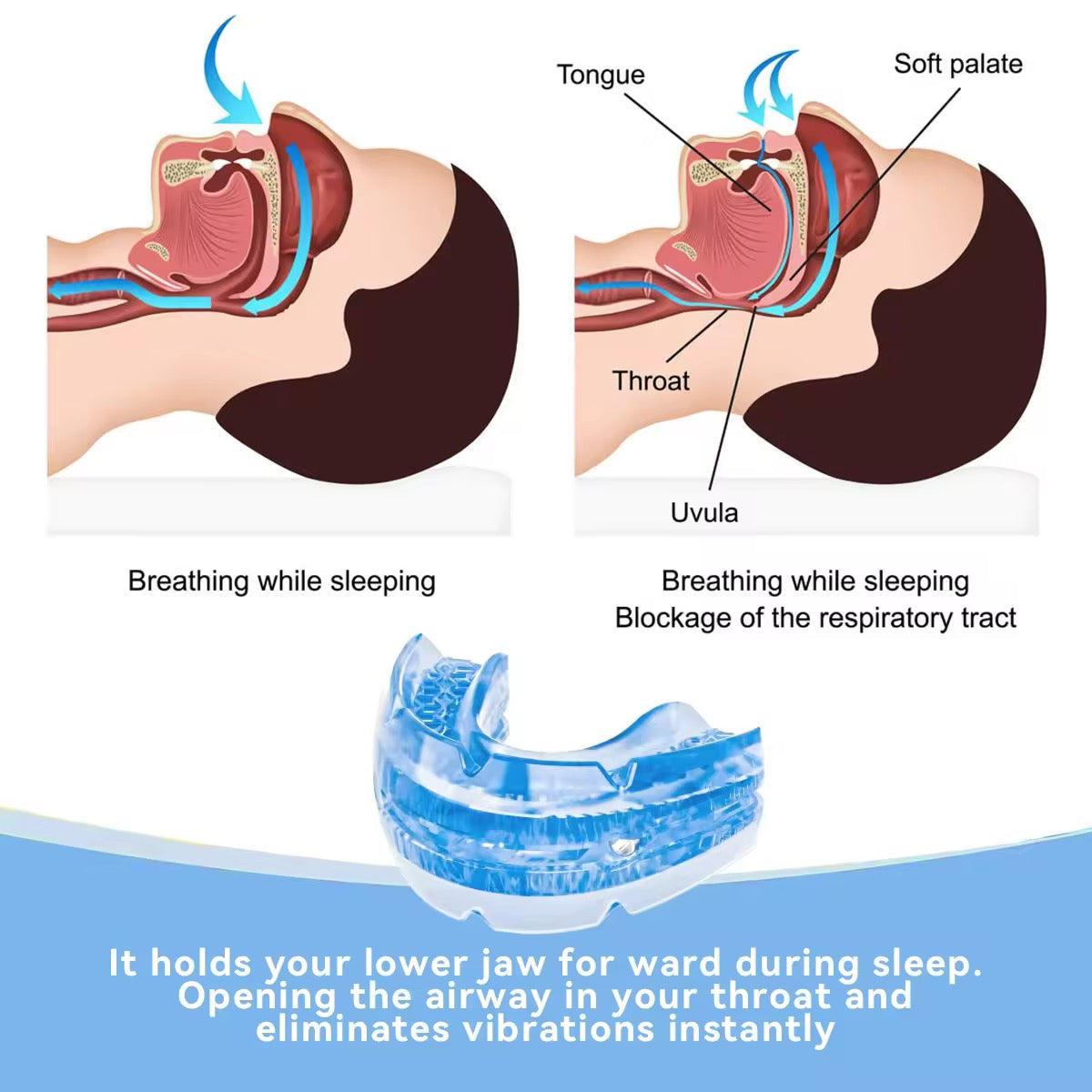 The Most Effective Anti-Snore Mouthpiece